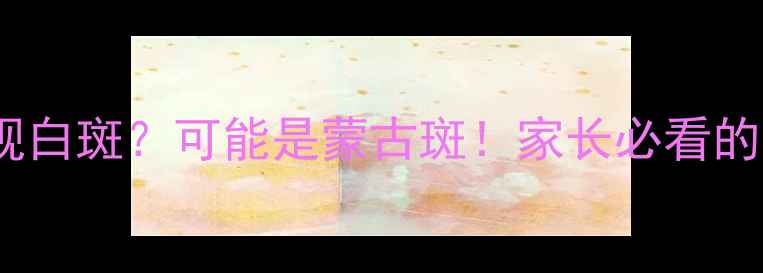图片 🌟3个月宝宝后背出现白斑？可能是蒙古斑！家长必看的护理指南与就医时机